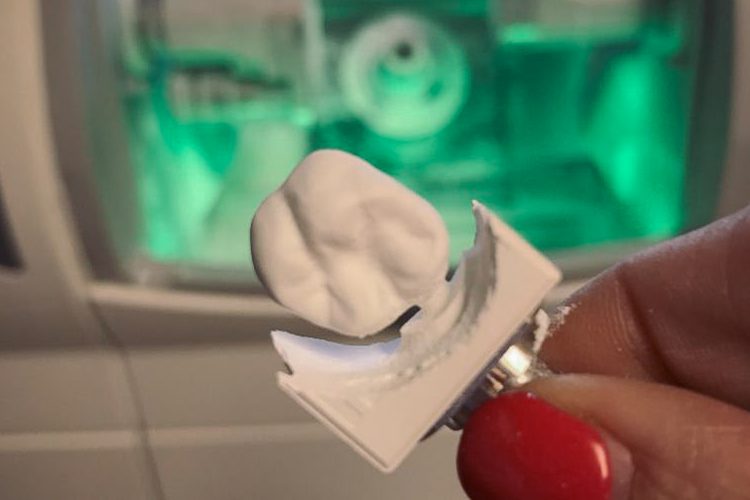 Fiser Family Dental Care CEREC